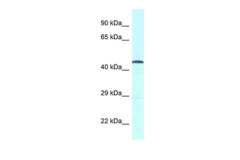 GPR52 Rabbit Polyclonal Antibody
