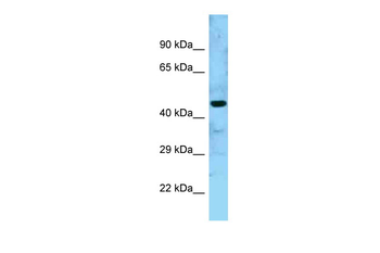 GTPBP5 Rabbit Polyclonal Antibody