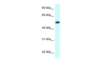 NAPRT Rabbit Polyclonal Antibody