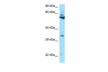 TMEM192 Rabbit Polyclonal Antibody