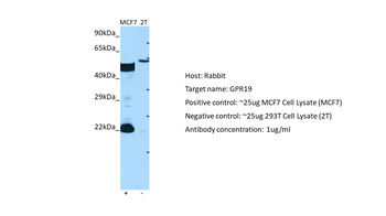GPR19 Rabbit Polyclonal Antibody