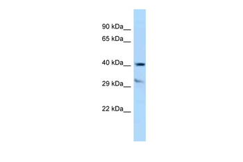 TTPA Rabbit Polyclonal Antibody