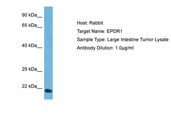 EPDR1 Rabbit Polyclonal Antibody