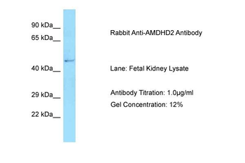 AMDHD2 Rabbit Polyclonal Antibody