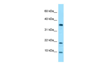 SNRPE Rabbit Polyclonal Antibody
