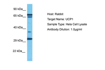 UCP1 Rabbit Polyclonal Antibody