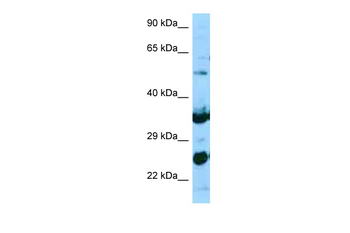 NPL Rabbit Polyclonal Antibody