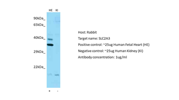 SLC2A3 Rabbit Polyclonal Antibody