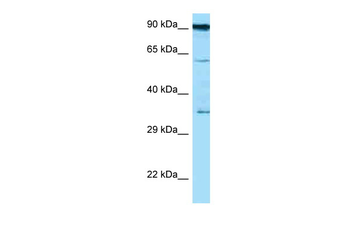 CD82 Rabbit Polyclonal Antibody