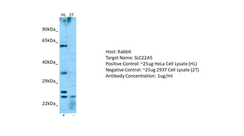 SLC22A5 Rabbit Polyclonal Antibody