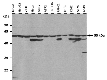 SLC19A2 Rabbit Polyclonal Antibody