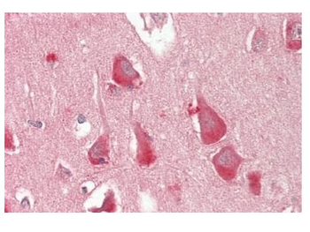 FADS2 Rabbit Polyclonal Antibody