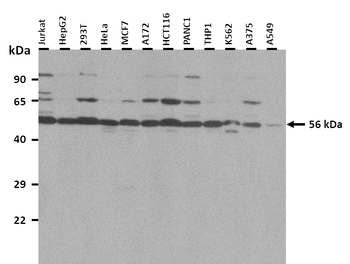 KMO Rabbit Polyclonal Antibody
