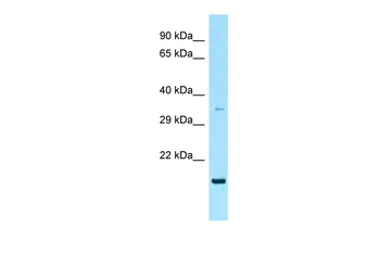RAP2A Rabbit Polyclonal Antibody