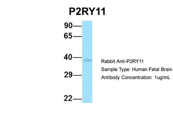 P2RY11 Rabbit Polyclonal Antibody