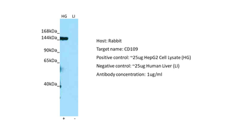 CD109 Rabbit Polyclonal Antibody