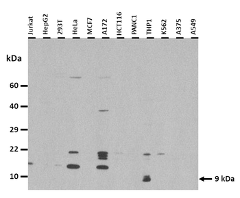 NUPR1 Rabbit Polyclonal Antibody
