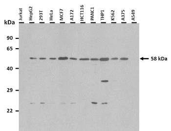 SPAM1 Rabbit Polyclonal Antibody