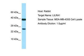 LILRA1 Rabbit Polyclonal Antibody