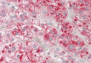 DUOXA2 Rabbit Polyclonal Antibody