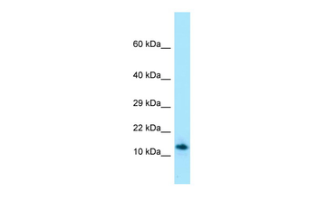 SPRN Rabbit Polyclonal Antibody