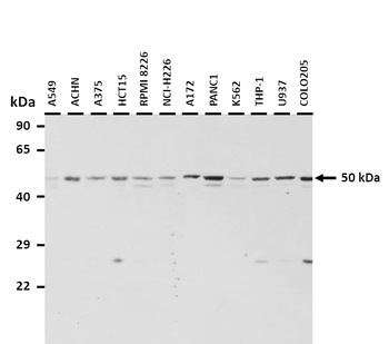 L2HGDH Rabbit Polyclonal Antibody