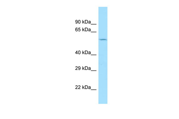 CCZ1 Rabbit Polyclonal Antibody