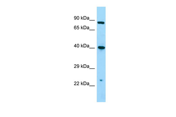 NMUR1 Rabbit Polyclonal Antibody