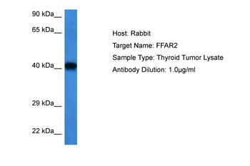 FFAR2 Rabbit Polyclonal Antibody