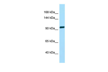 TAS1R2 Rabbit Polyclonal Antibody