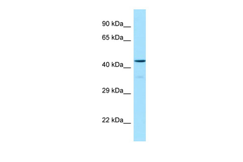HCRTR1 Rabbit Polyclonal Antibody