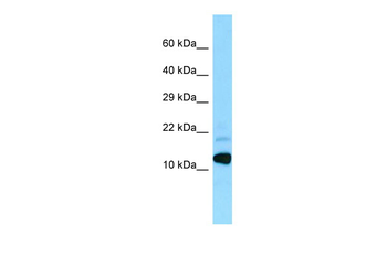 BRI3 Rabbit Polyclonal Antibody
