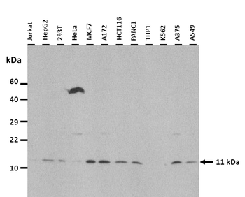 DYNLRB1 Rabbit Polyclonal Antibody