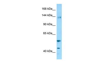 ENPEP Rabbit Polyclonal Antibody