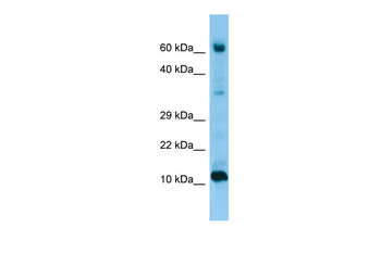 FABP9 Rabbit Polyclonal Antibody
