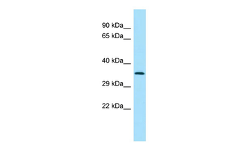SPG21 Rabbit Polyclonal Antibody