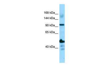 ADAMTS14 Rabbit Polyclonal Antibody