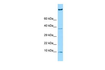 HGSNAT Rabbit Polyclonal Antibody