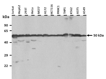 TUBB2B Rabbit Polyclonal Antibody