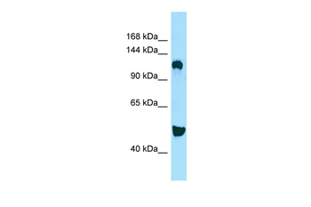 DGKD Rabbit Polyclonal Antibody