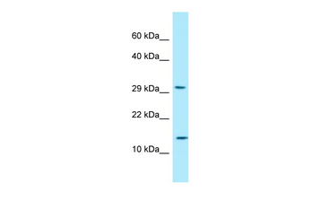 RPLP2 Rabbit Polyclonal Antibody