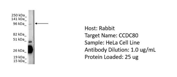 CCDC80 Rabbit Polyclonal Antibody