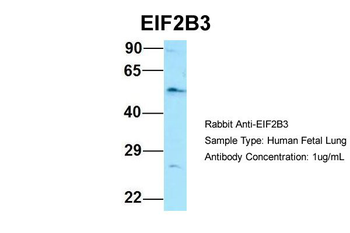 EIF2B3 Rabbit Polyclonal Antibody
