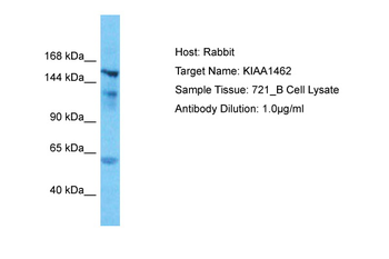 JCAD Rabbit Polyclonal Antibody