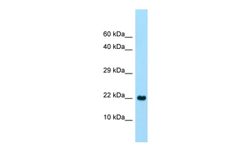 CLEC2A Rabbit Polyclonal Antibody