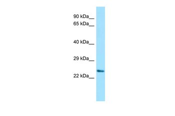 DPRX Rabbit Polyclonal Antibody