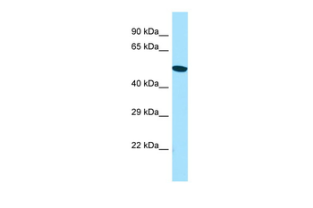 ACTR6 Rabbit Polyclonal Antibody