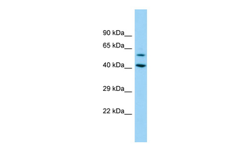 DEPDC1B Rabbit Polyclonal Antibody
