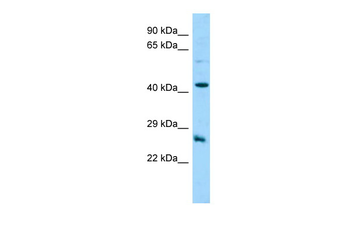 C18orf26 Rabbit Polyclonal Antibody
