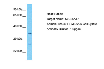 SLC25A17 Rabbit Polyclonal Antibody